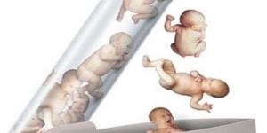 试管婴儿可以进行性别选择吗？二胎生男孩压力太大了？