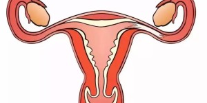 输卵管切除做试管婴儿还会宫外孕吗？