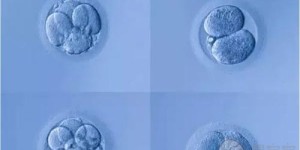 2022银川正规民营供卵机构名单火热发布，附供卵试管试管婴儿条件一览