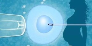 冷冻精子做试管成功率解答：除质量外影响因素还很多