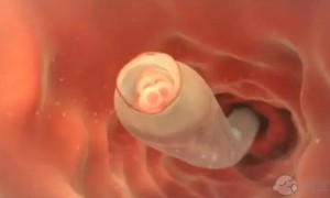 42岁闭经有窦卵泡能做试管吗？生殖专家来告诉你答案