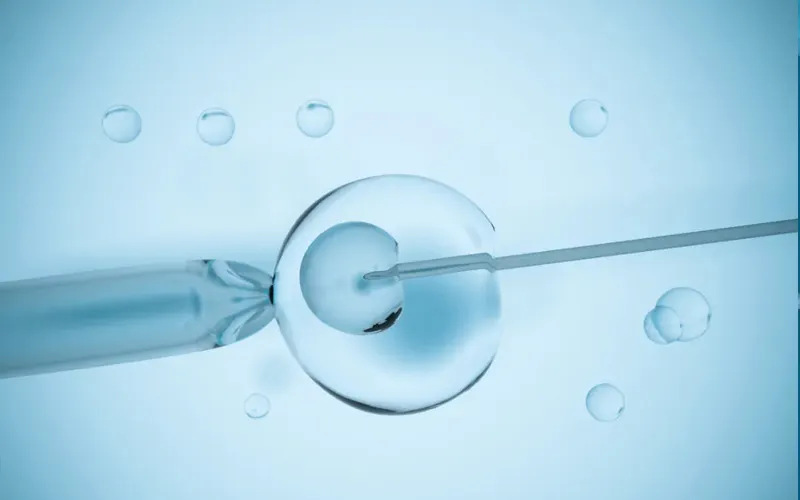 胚胎移植的成本
