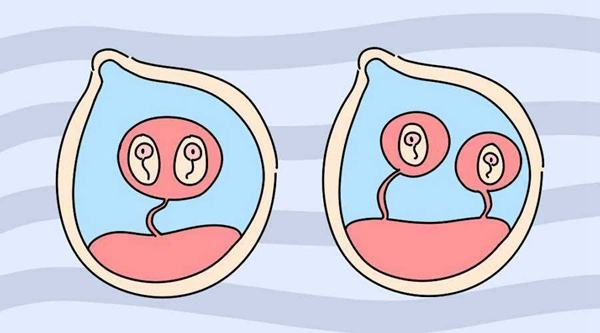 试管婴儿想生双胞胎就能生？试管婴儿生双胎很简单吗？
