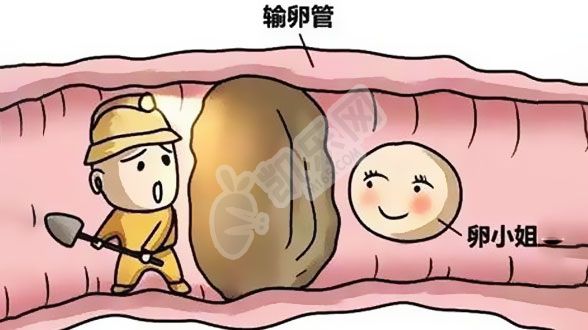 输卵管堵塞是复通还是试管婴儿好？(图2)