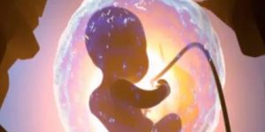 专家解读：试管婴儿监测排卵的目的是什么？附试管前监测排卵时间表