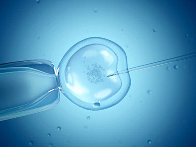 染色体异常患者可以做试管婴儿吗？应该选择哪一代？