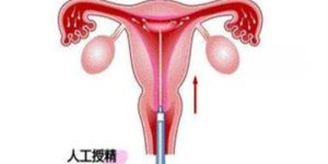 重庆市妇幼做三代试管婴儿多少钱？附上试管详细费用
