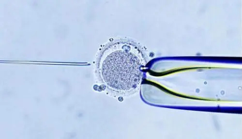 胚胎移植腹水有哪些症状