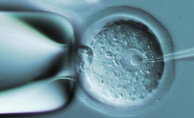 医院胚胎冷冻收费标准来了，是不是分开计算快来看看？