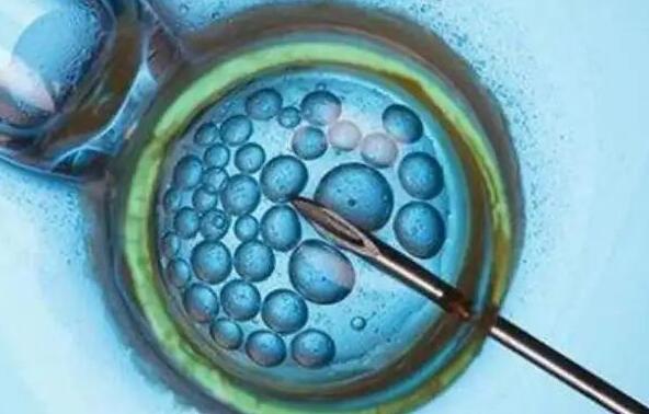 人工胚胎可以选择性别吗？附人工生男孩方法？
