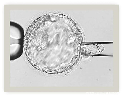 卵巢早衰能做供卵试管吗 卵巢早衰患者做试管能一次成功吗