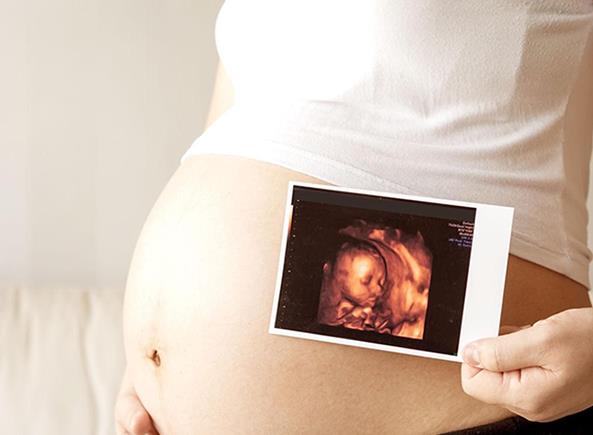 为什么二胎怀孕6个月做了两次四维说是女孩却生了男孩？
