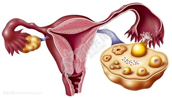 卵巢早衰做试管的成功率是多少？用什么办法进行试管婴儿？(图2)