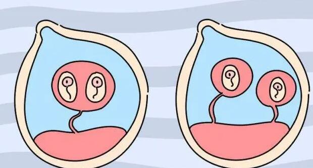 试管婴儿男双胞胎的费用多少？附费用明细？