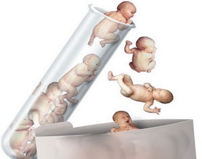 试管婴儿可以进行性别选择吗？二胎生男孩压力太大了？