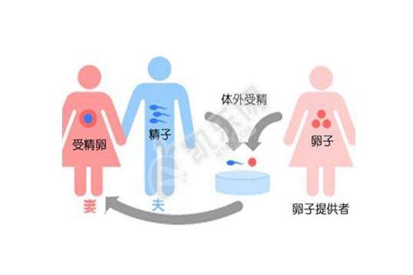 2022上海做一次供卵试管婴儿真不贵，内含助孕费用明细表(图1)