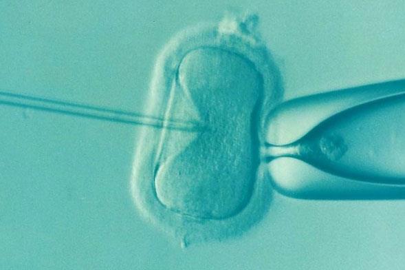 俄罗斯精子库可以选择胚胎的性别吗？