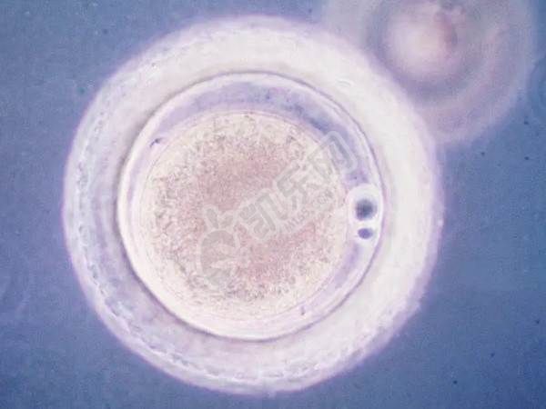 医生能通过冻胚形态分辨出是男孩还是女孩吗
