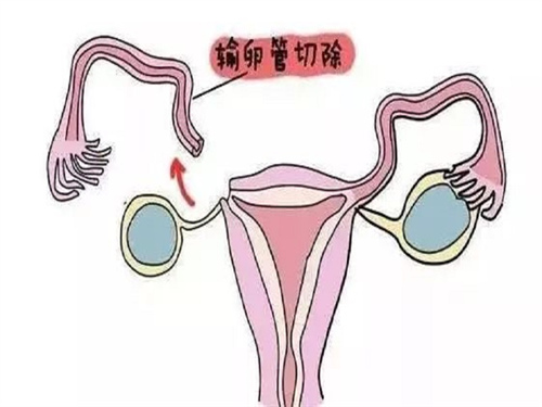 北京试管供卵助孕攻略参考 附北京供卵机构排名
