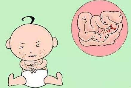 助孕专家：试管婴儿做B超不宜过多，对宝宝有影响