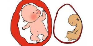 试管婴儿想生双胞胎就能生?试管婴儿生双胎很简单吗?