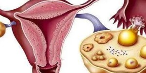 吃氯米芬如何发挥促排作用？掌握正确吃法效果看得到