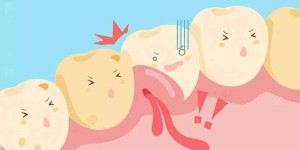 虫牙疼怎么缓解？最快最有效的4个方法推荐