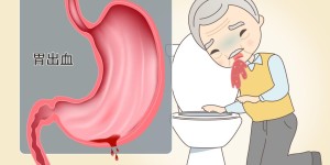 胃出血是什么原因引起的？胃出血要怎么办？