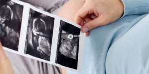 家属要怎么委婉询问四维彩超医生胎儿是男是女呢？