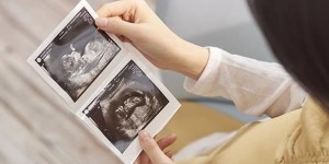 怀孕14周彩超图片分享，看男女技巧、准确率已整理好！