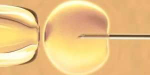 二胎试管囊胚移植流程，从检查到移植三步缺一不可