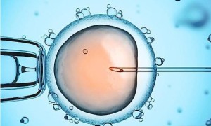 单侧输卵管粘连选择做三代试管能指定孩子性别吗？