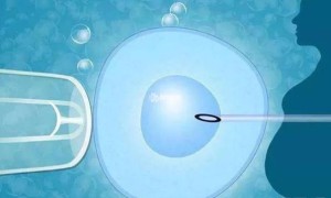 36岁单角子宫做1代试管移植鲜胚的成功率高么？