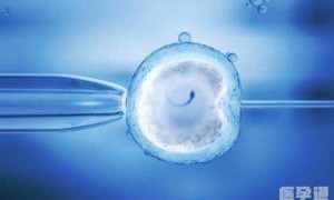 单身女人可以买精子做试管受孕吗?
