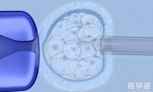 2023年做四代试管从体检到胚胎移植要准备多少钱？