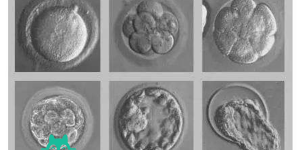 高龄女性做试管适合移植哪种胚胎？冻胚还是鲜胚成功率高？