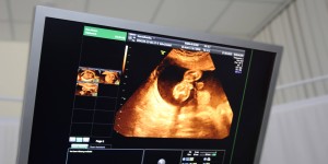 三代试管婴儿人工周期流程是怎样的？