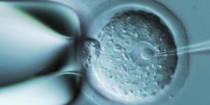 三代试管婴儿胚胎染色体异常怎么办？会出现21三体综合征吗？