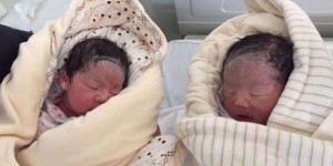中山博爱医院人工受孕生一对双胞胎价格是多少？