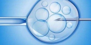 2022贵阳供卵试管婴儿生男孩医院排名？
