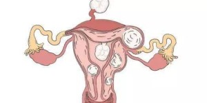 宫颈炎会影响胎儿发育吗?孕期如何预防宫颈炎？