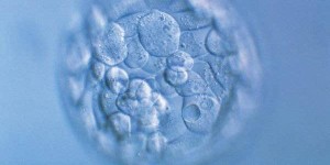 鲜胚移植后注意事项？鲜胚移植一定要比冻胚成功高吗？