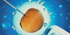 贵州医科大学附属医院做三代试管供卵试管婴儿费用公布