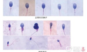 最新2023郑州赠卵试管选性别医院名单！附3家医院详细说明