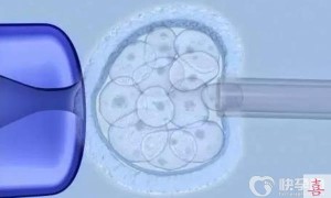 2023湖南赠卵试管婴儿医院排名，附试管费用明细