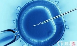 y精子筛选是真的吗？能做试管吗？