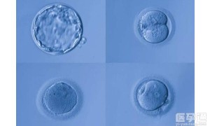 2023在国内三甲医院做供卵试管找关系提前排队要多久？