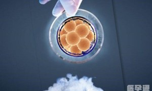 　俄罗斯试管移植两个囊胚生龙凤胎成功率多少？