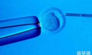 国内哪家正规医院可以做试管婴儿xy精子分离术生男孩？