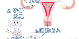 南京鼓楼医院做三代试管婴儿可以选性别生男生女吗？
